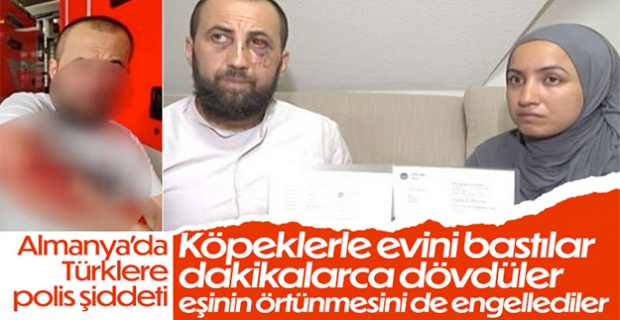 Almanya'da Türk aileye polis şiddeti